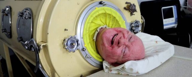 Polio Survivor Who Lived in Iron Lung For 7 Decades Dies at 78