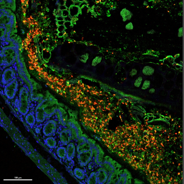 yeast under a fluorescent microscope