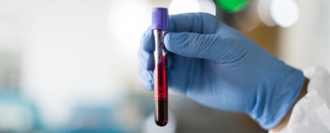 Damaged DNA Could Warn of Parkinson's Long Before Symptoms