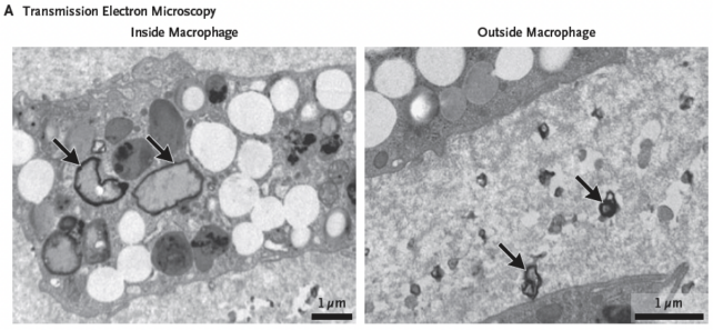 Panel of two black and white images showing jagged plastic particles, marked with arrows, in tissue sections, viewed under a microscope.