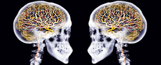 Two Skulls With Brains And Neurons