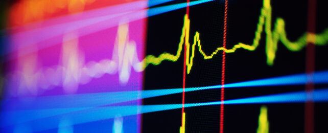 cardiac rhythm on screen