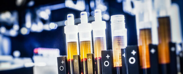 blood samples in a laboratory