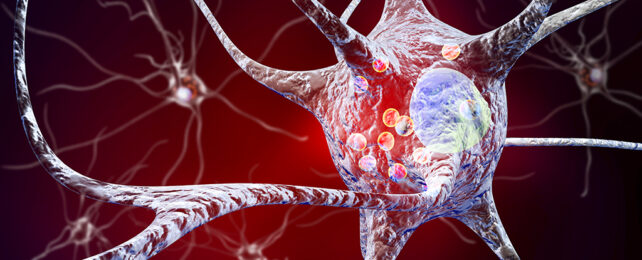 lewy bodies in a neuron