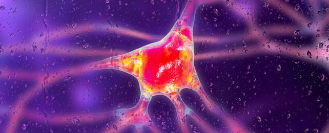 Alzheimer's neuron