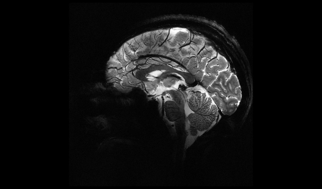 Brain MRI