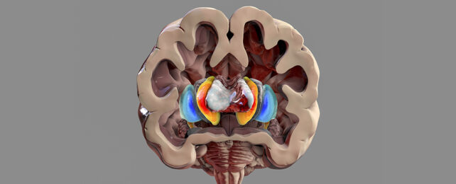 Brain cross section