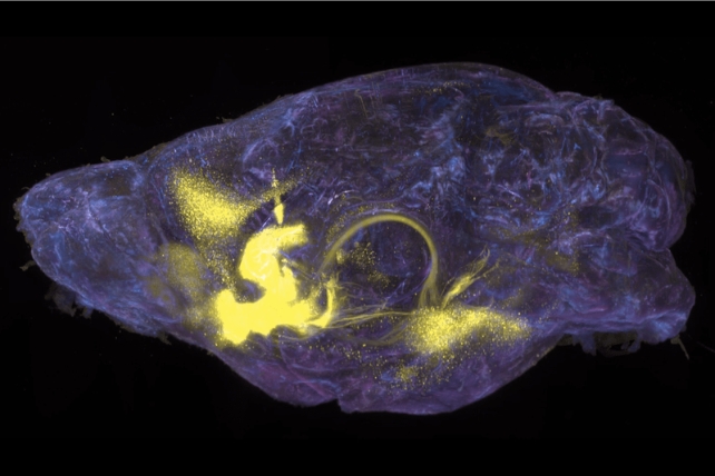 A mouse brain in purple showing neurons projecting in yellow