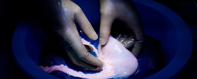 Gloved hands lifting an organ out of a bowl