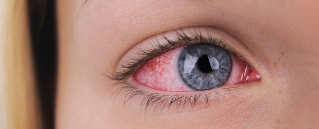 Red an irritated women's blue eye