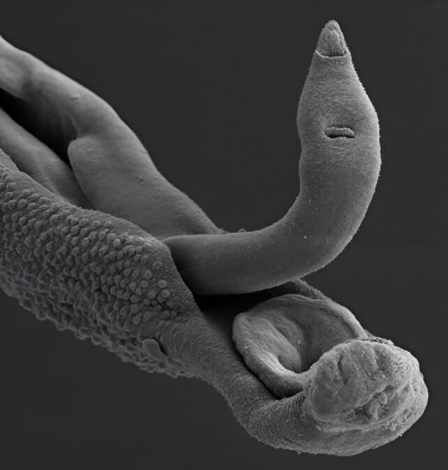 Microscope image of two entangled parasitic worms.