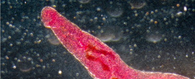 Microscope image of Schistosoma worm, stained pink.