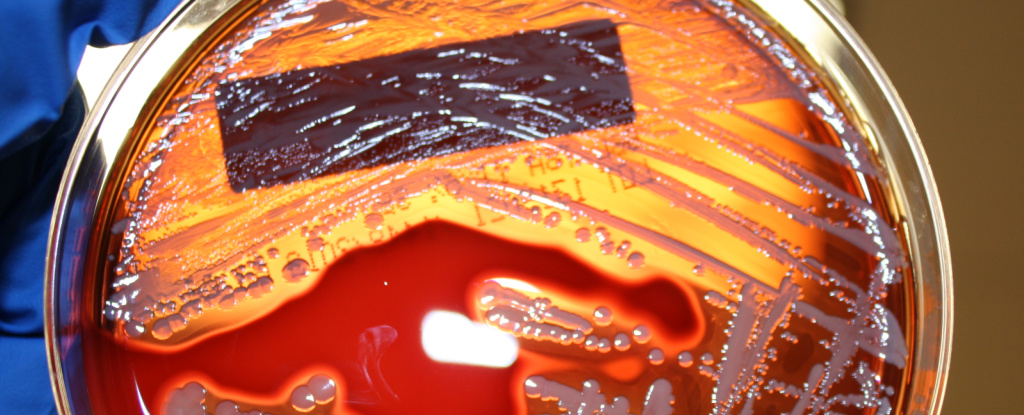 Bacteria growing in petri dish with red agar, held up by blue-gloved hand.