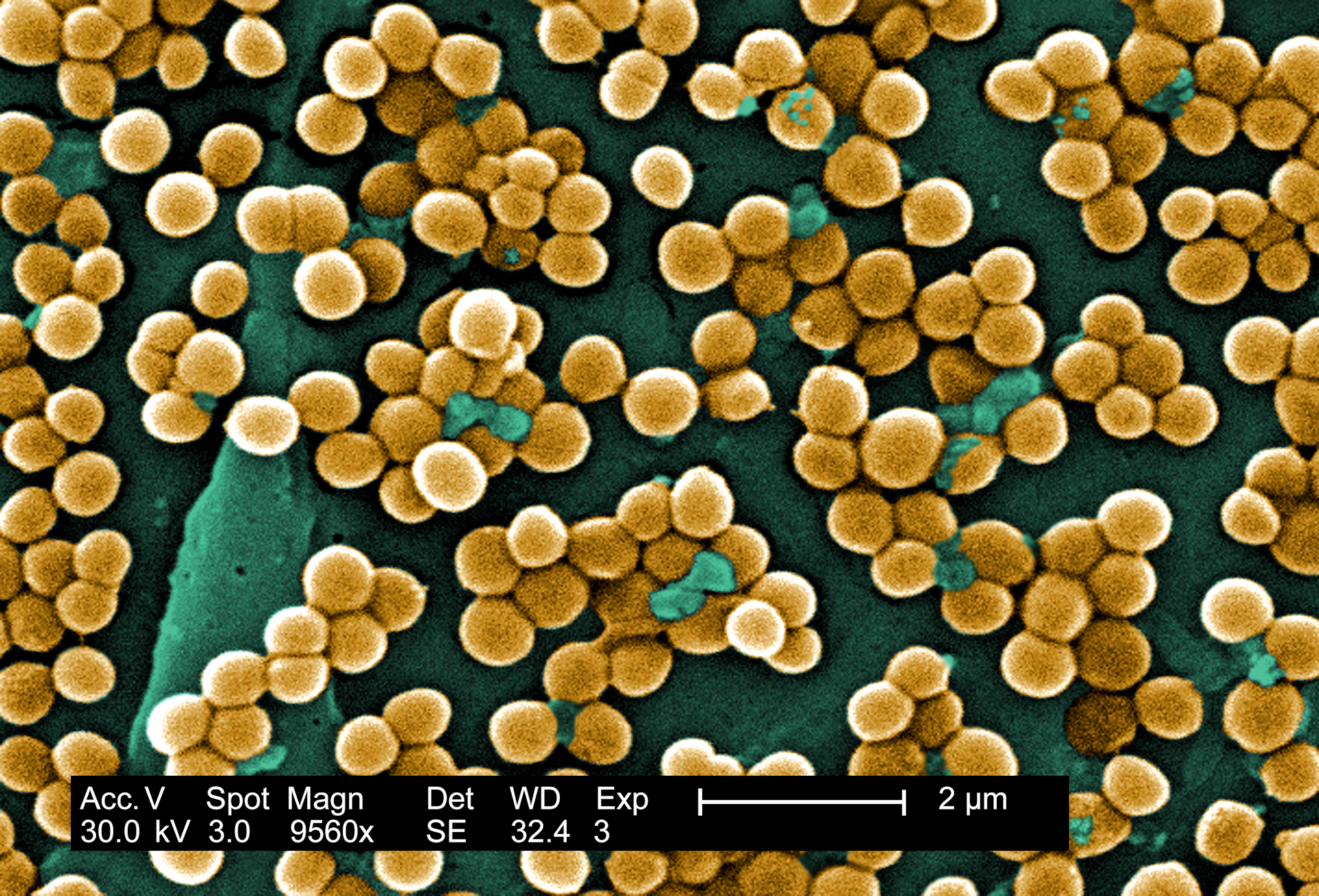 Los científicos revelan de dónde provienen realmente la mayoría de las infecciones 'hospitalarias': ScienceAlert