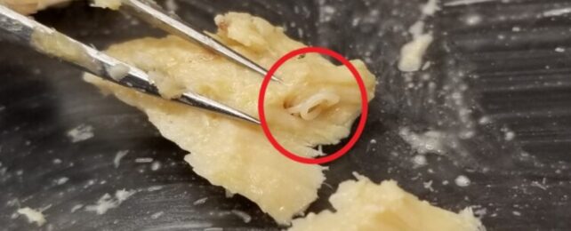 A photo of an anisakid worm — circled in red — in a canned salmon fillet.