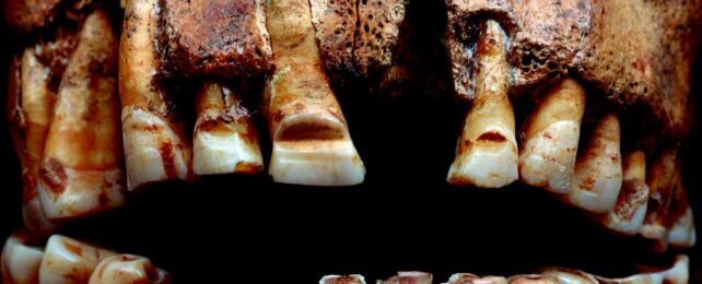 Vikings Filed Grooves Into Their Teeth as an Unusual Form of ID
