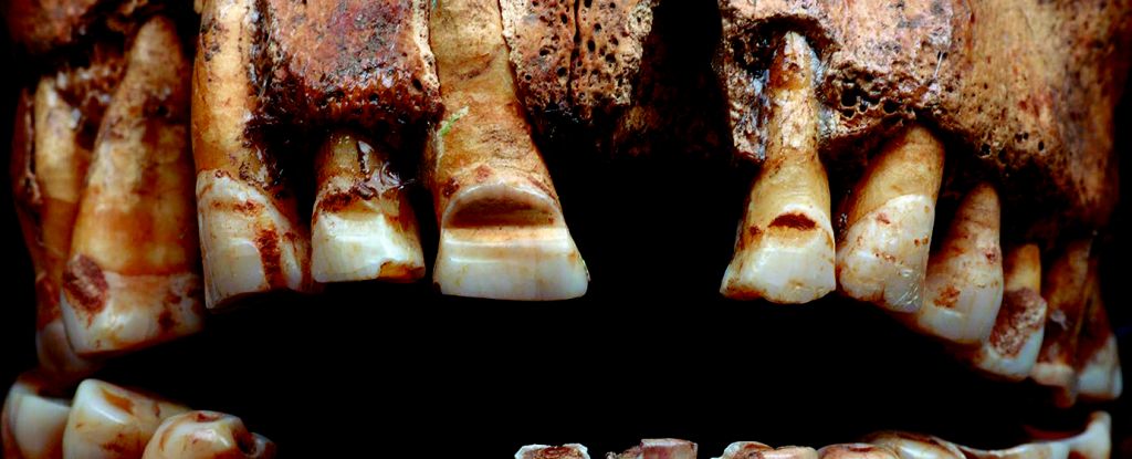 Los vikingos limaron ranuras en sus dientes como una forma inusual de identificación: Heaven32