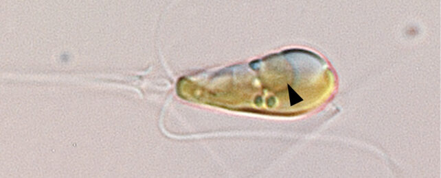 A Rare Event Gave This Algae an Organelle That Traps And Uses Nitrogen