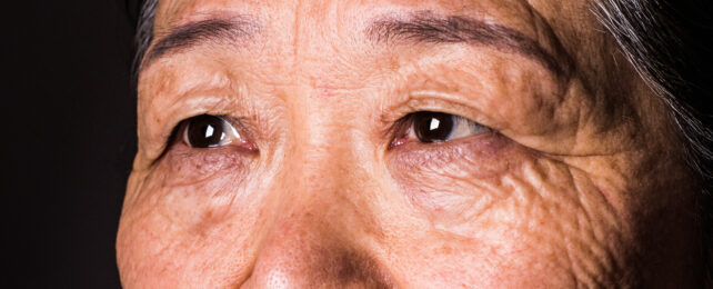 Your Vision Can Predict Dementia 12 Years Before Diagnosis, Study Finds