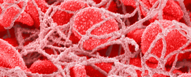 Red blood cells in human blood clot.