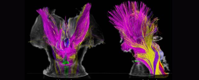 Multicoloured nuclei shown on MRI scans