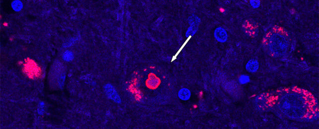 Genome scan