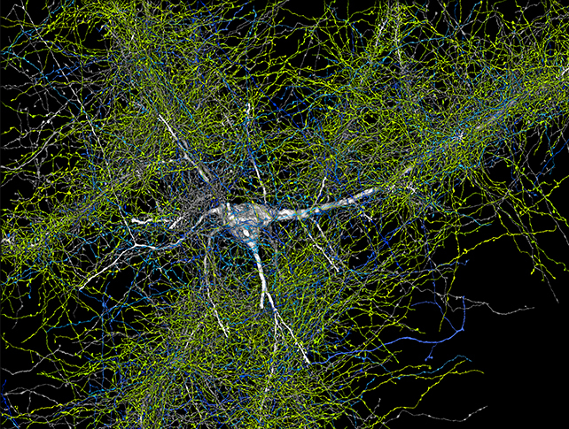 A neuron and axons