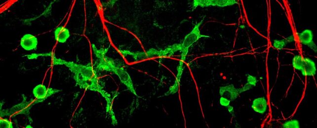 microglial cells