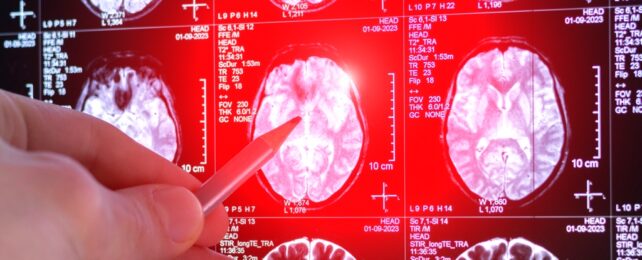 Pen taps on brain scan