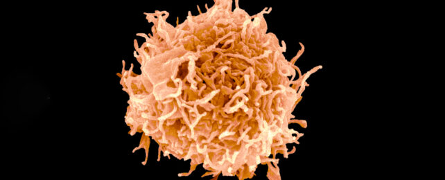 Scanning electron micrograph of a B cell colored orangey pink