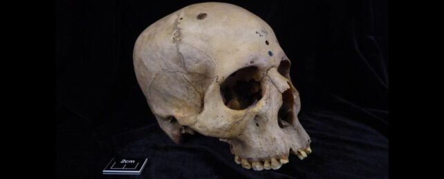 Ancient Egyptian Skull Found Riddled With Tiny Cut Marks. This Could Be Why.