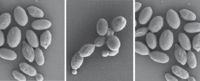 Yeast forming colonies at higher temperatures under the microscope