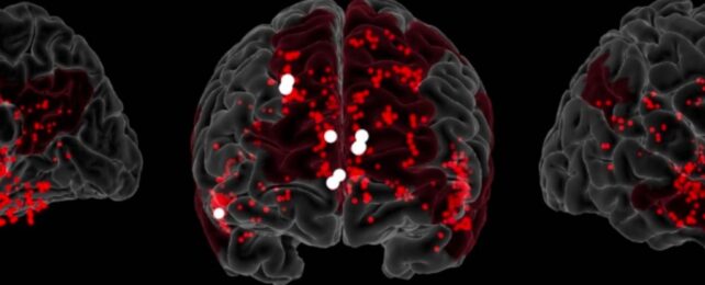 Scientists Identify Neural Network Vital For Creativity in The Brain