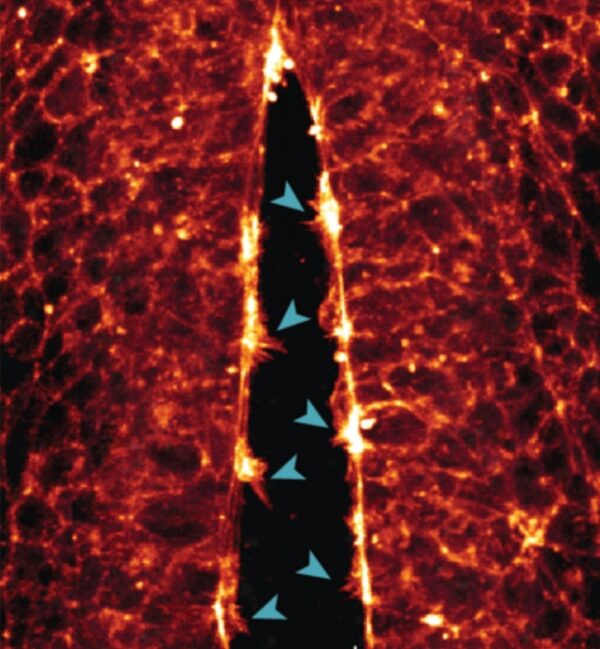 Incredible New Tech Lets Scientists Watch Fetuses Develop in Real Time ...
