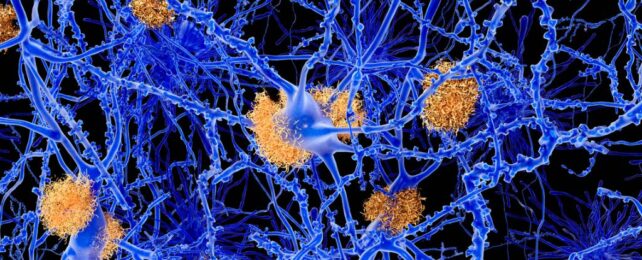 3D illustration of neural network gummed up by plaques