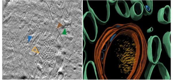 3D Molecular Structure of Alzheimer's Brains Revealed For The First ...