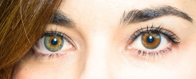 A face with one green and one brown eye