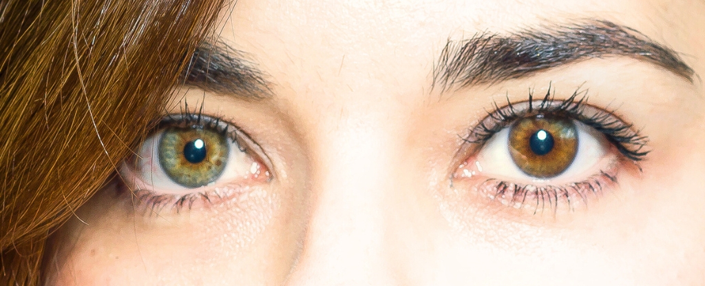 Las cirugías para cambiar el color de los ojos son una tendencia peligrosa, advierte un experto : Heaven32