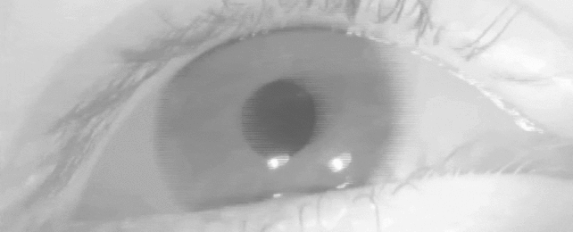 A small quirk in your eye movement may predict Alzheimer's risk