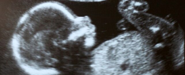 Fetus Receives Life-Saving Medication Before Birth in Medical First