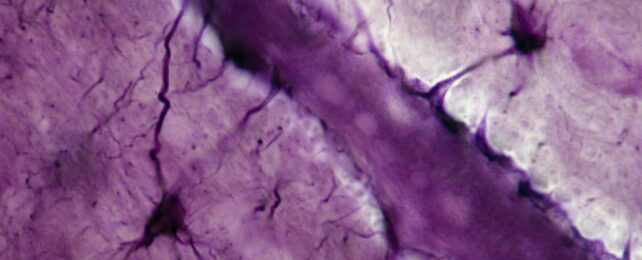 Brain Receptors For Cannabis Could Be Why Some People Are More Resilient