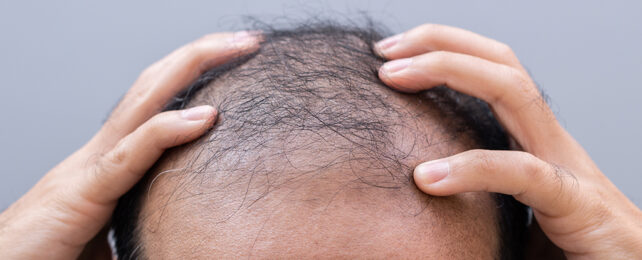 Balding head