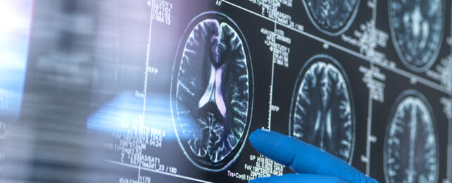 Brain scan