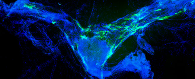 Lymphatic vessels