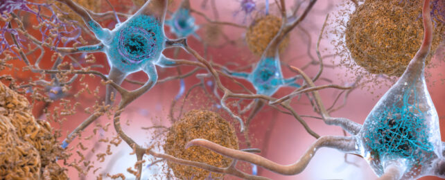 illustration of beta-amyloid plaques and tau protein in the brain, both of which are associated with Alzheimer's disease