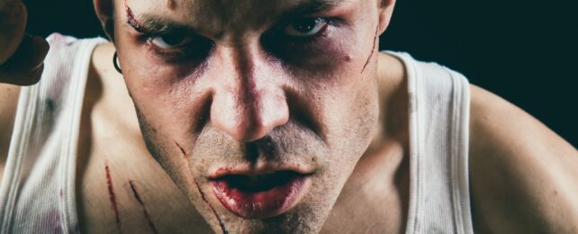 angry man with injuries