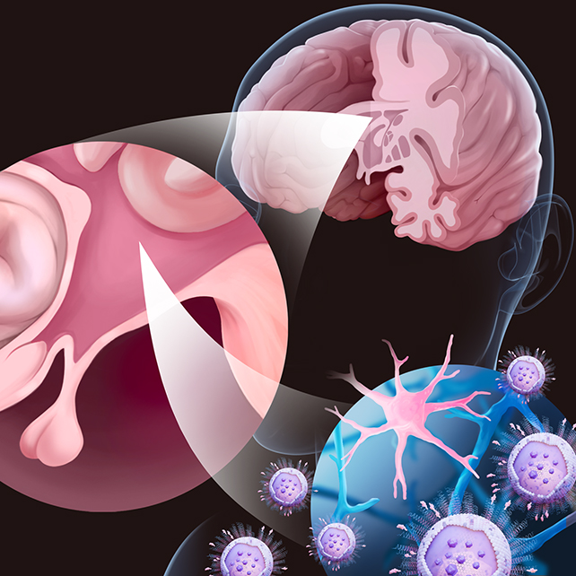 Brain treatments