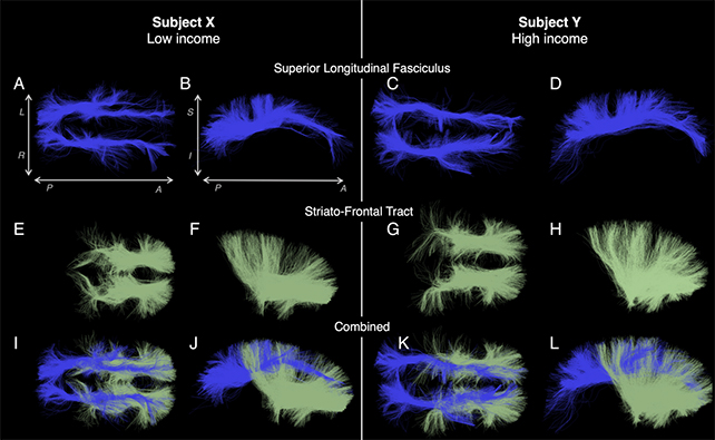 Brain images