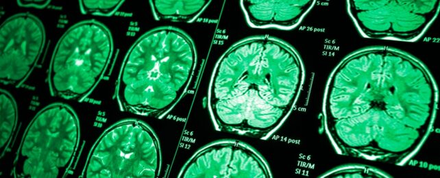 Brain Scans Grid