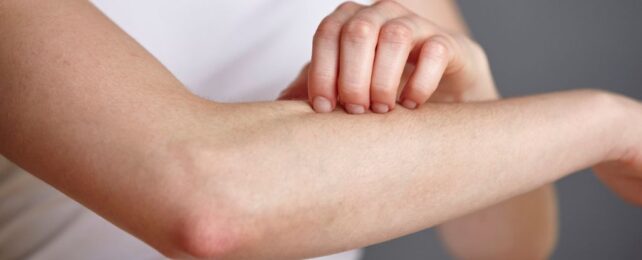 Fungi on Your Skin Could Produce a Potent Antibiotic to Fight Infections